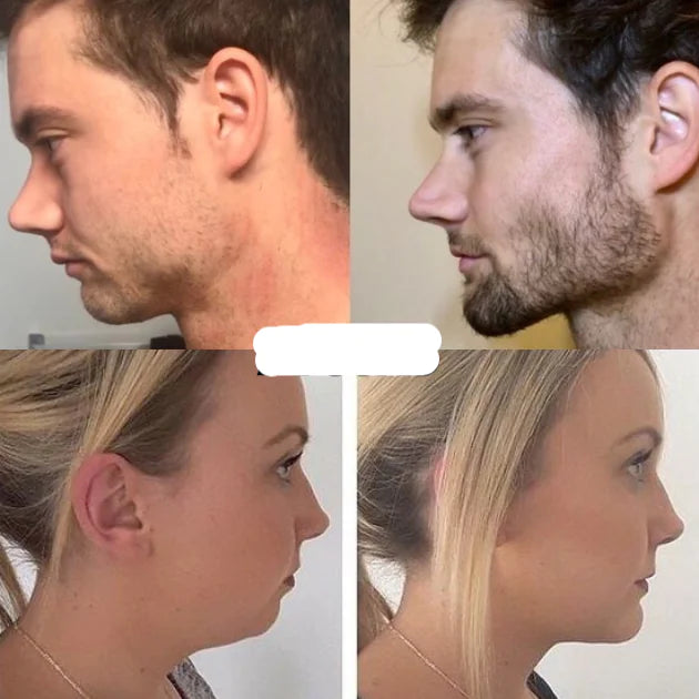 Fitness Jawline Trainer